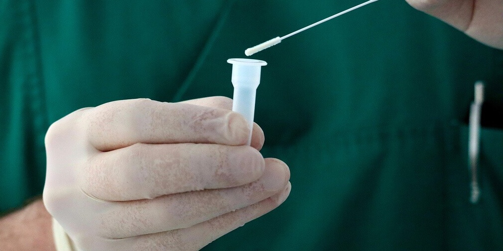 when will my covid 19 test be positive?